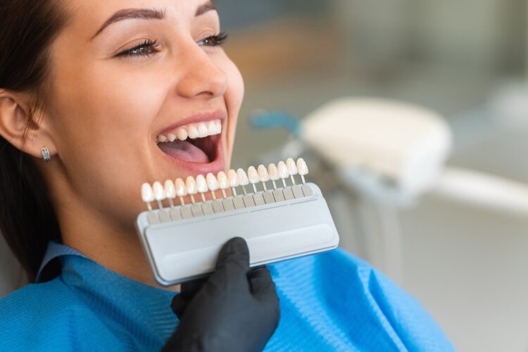 Choosing a shade of dental veneers